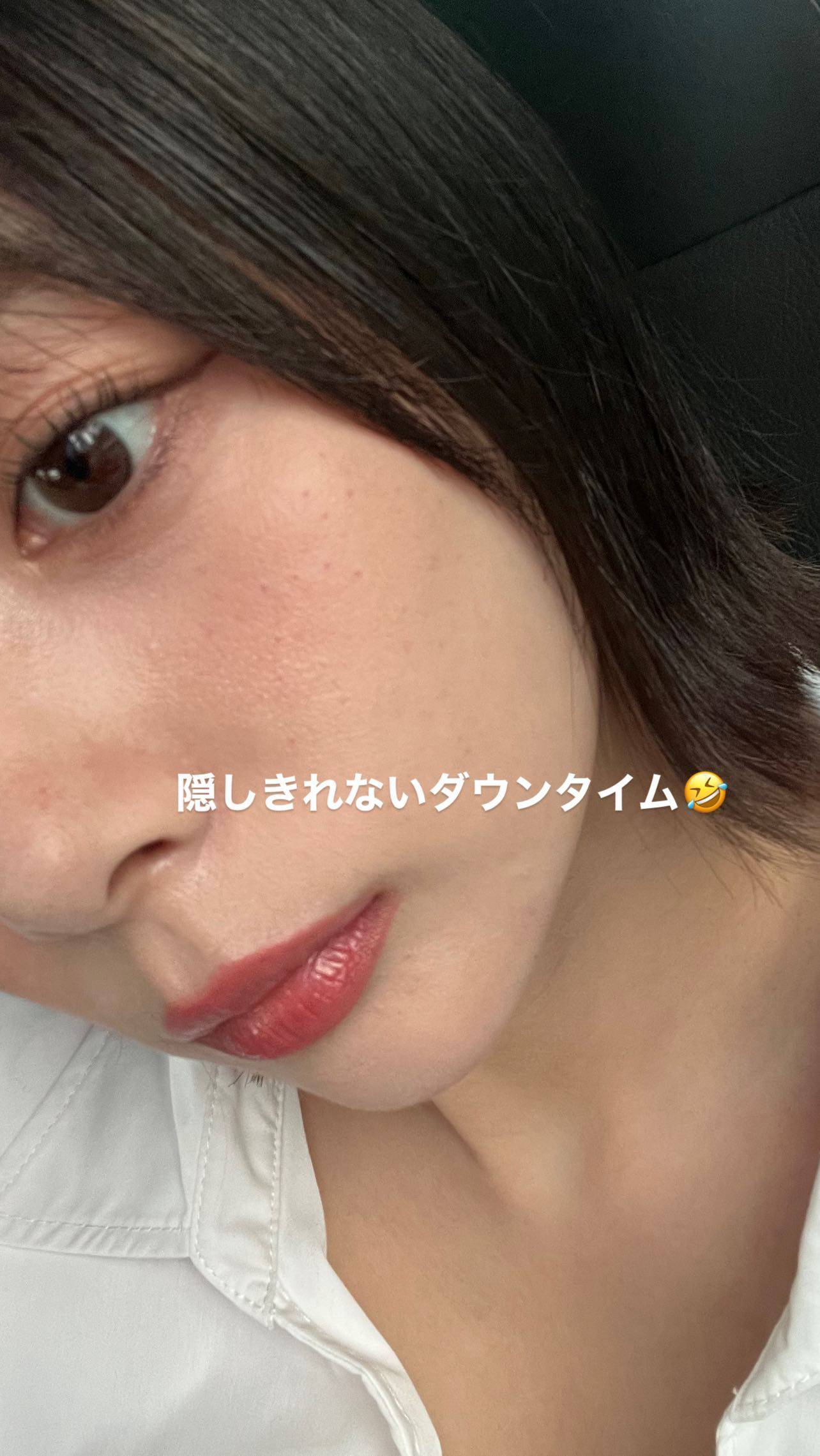 岡田 紗 佳 整形