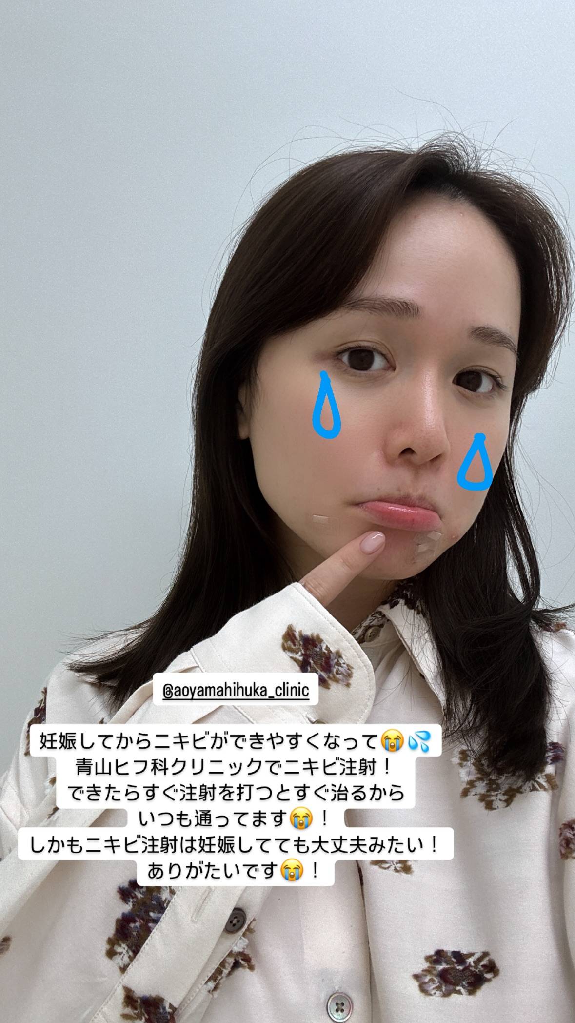 タレント妊婦 痛々しい〟顔面…10月妊娠発表の30歳元アイドルが妊娠後の悩み告白：「おっ！」でつながる地元密着のスポーツ応援メディア 西スポWEB OTTO!