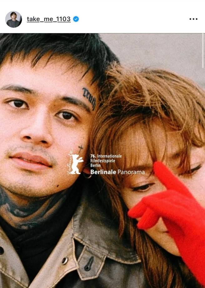 ゾワッとした」〝首にもびっしり〟北村匠海〝イメージ激変〟顔面