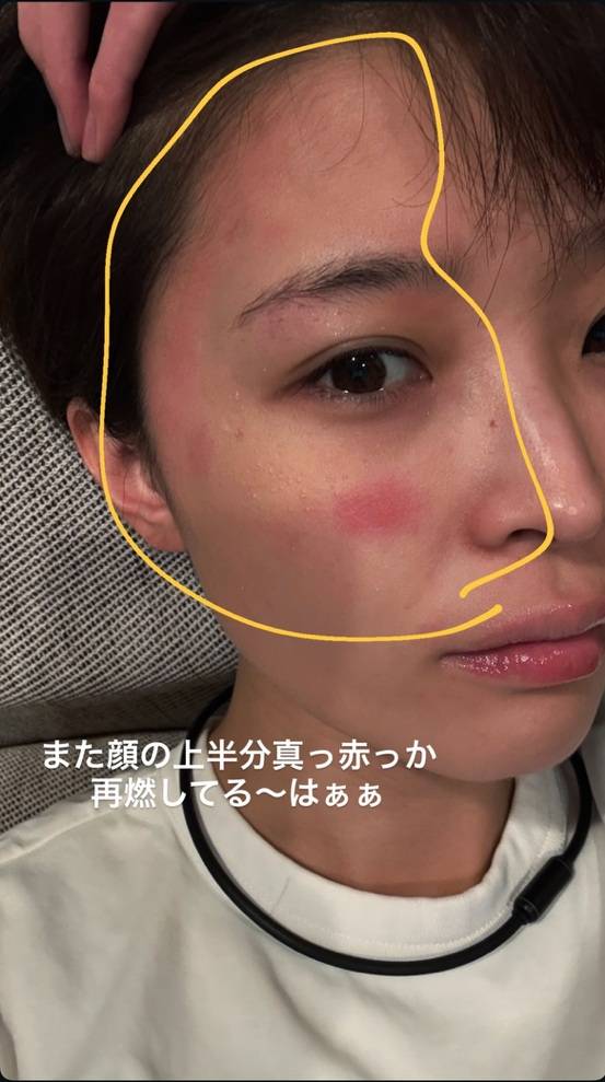 なんなの…」フジテレビ退社からもうすぐ2年…渡邊渚〝真っ赤な衝撃