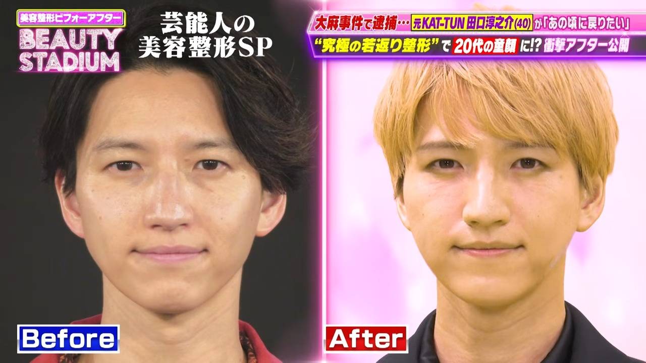 kat tun 田口
