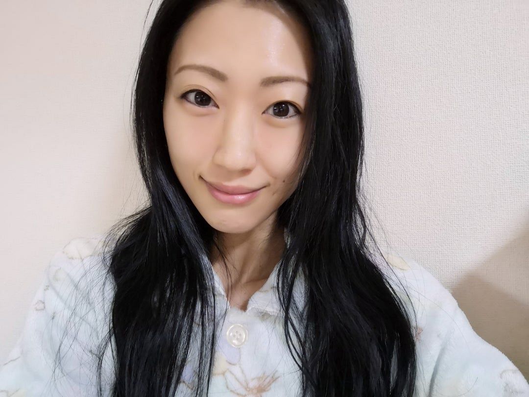 壇蜜 病気 何の病気