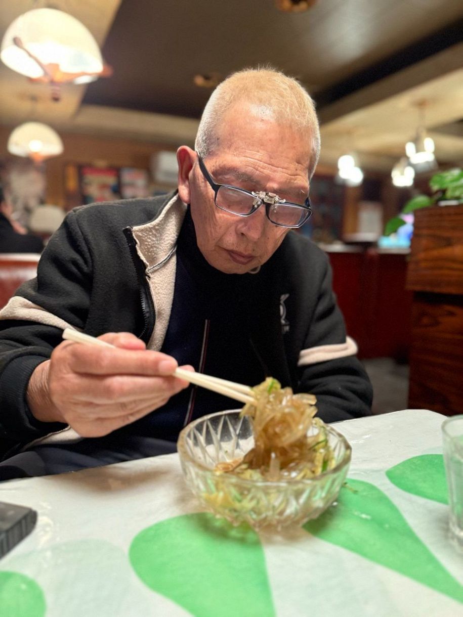 まれに癌化します」シミ除去施術公開、高須院長〝匠の技〟発揮！75歳